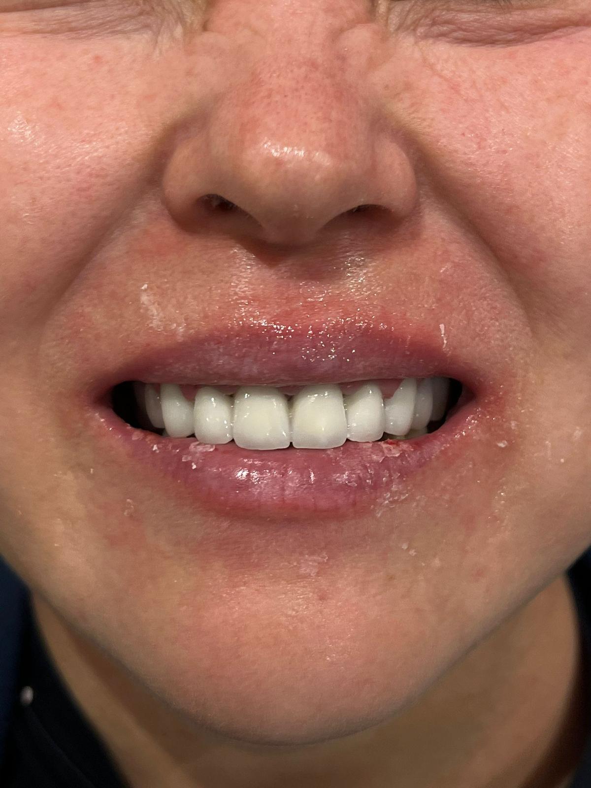 ECE Dental Patient Transformation